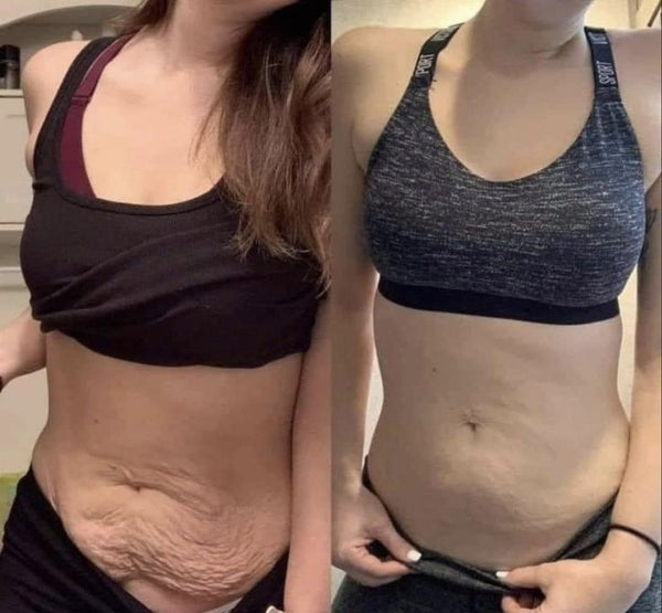 Skin feels tighter in just 1 month!